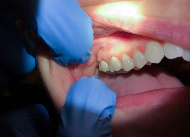 Best Cosmetic Emergency Dentistry in Bloomville, OH