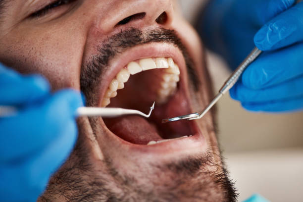 Best Emergency Denture Repair in Bloomville, OH